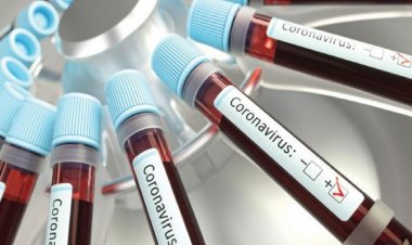 Covid Case : देश में तेजी से बढ़ रहे कोरोना के मामले, महाराष्ट्र में एक दिन में 65 नए केस