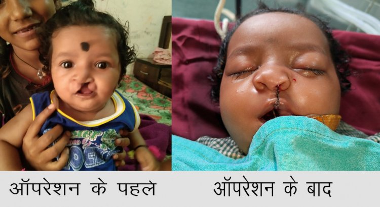 गंभीर बीमारियों से पीड़ित बच्चों को मिल रहा नया जीवन