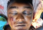 सिम्स में डॉक्टरों ने बचाई युवक की जान : गले की कटी श्वासनली की आपातकालीन सर्जरी कर दिया नया जीवन